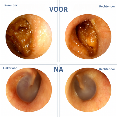 WaxClean™ – Slim oor reiniging met geavanceerde technologie