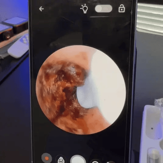 20 Jaar Oorsmeerophoping